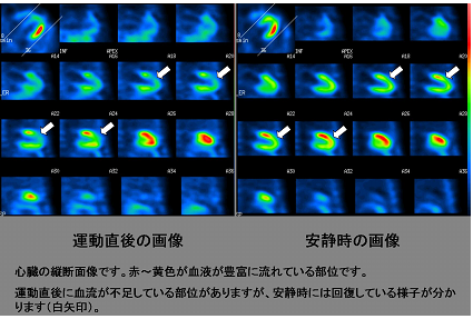 心臓の縦断画像
